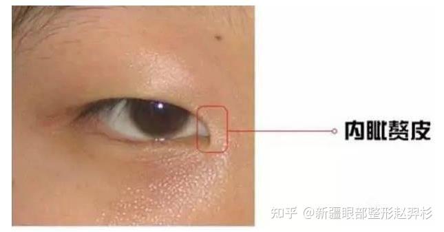 你眼睛不好看的原因都在这了 - 知乎