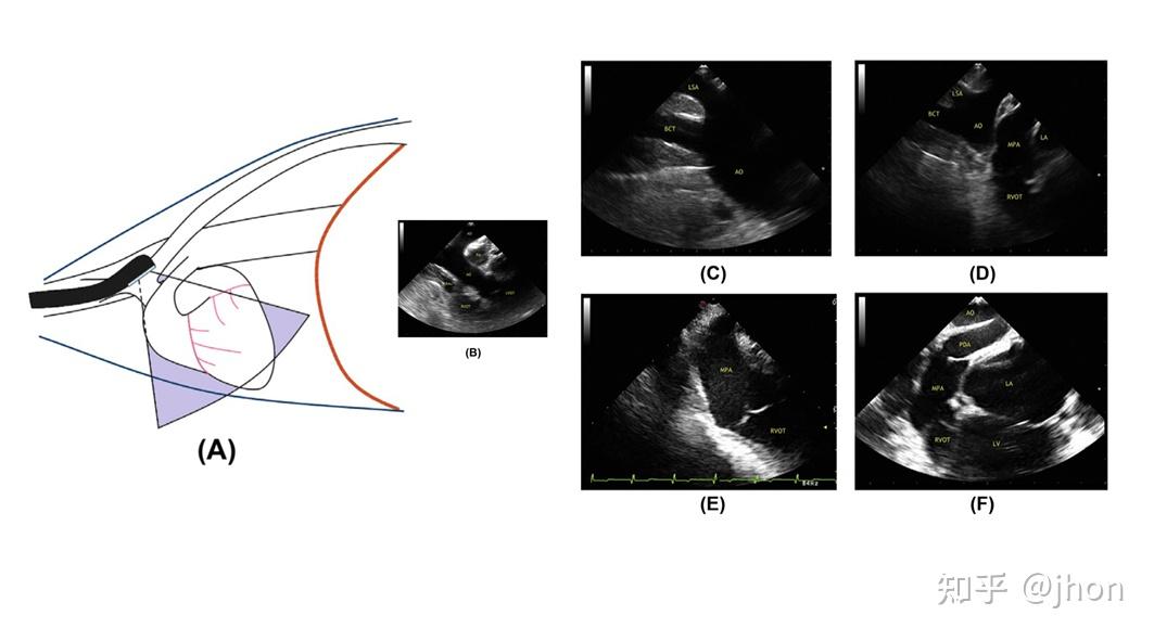 犬经食道超声心动图tee切面获取攻略