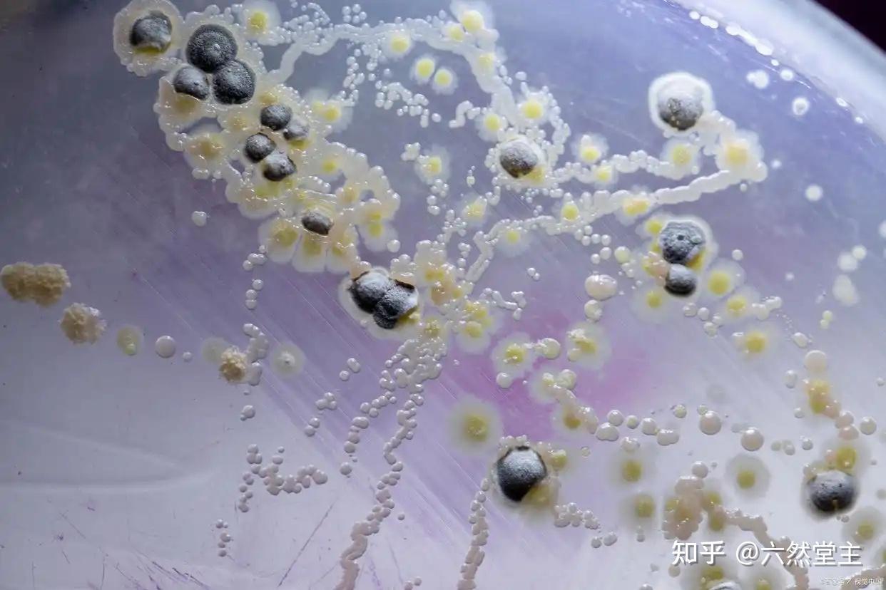 冰箱李斯特菌的特点及危害