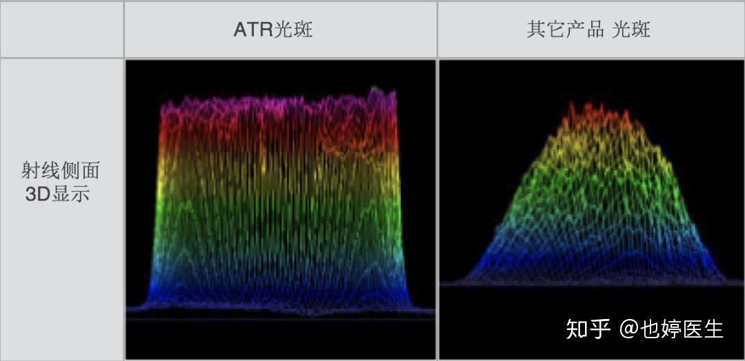 激光去斑什么原理_激光去斑