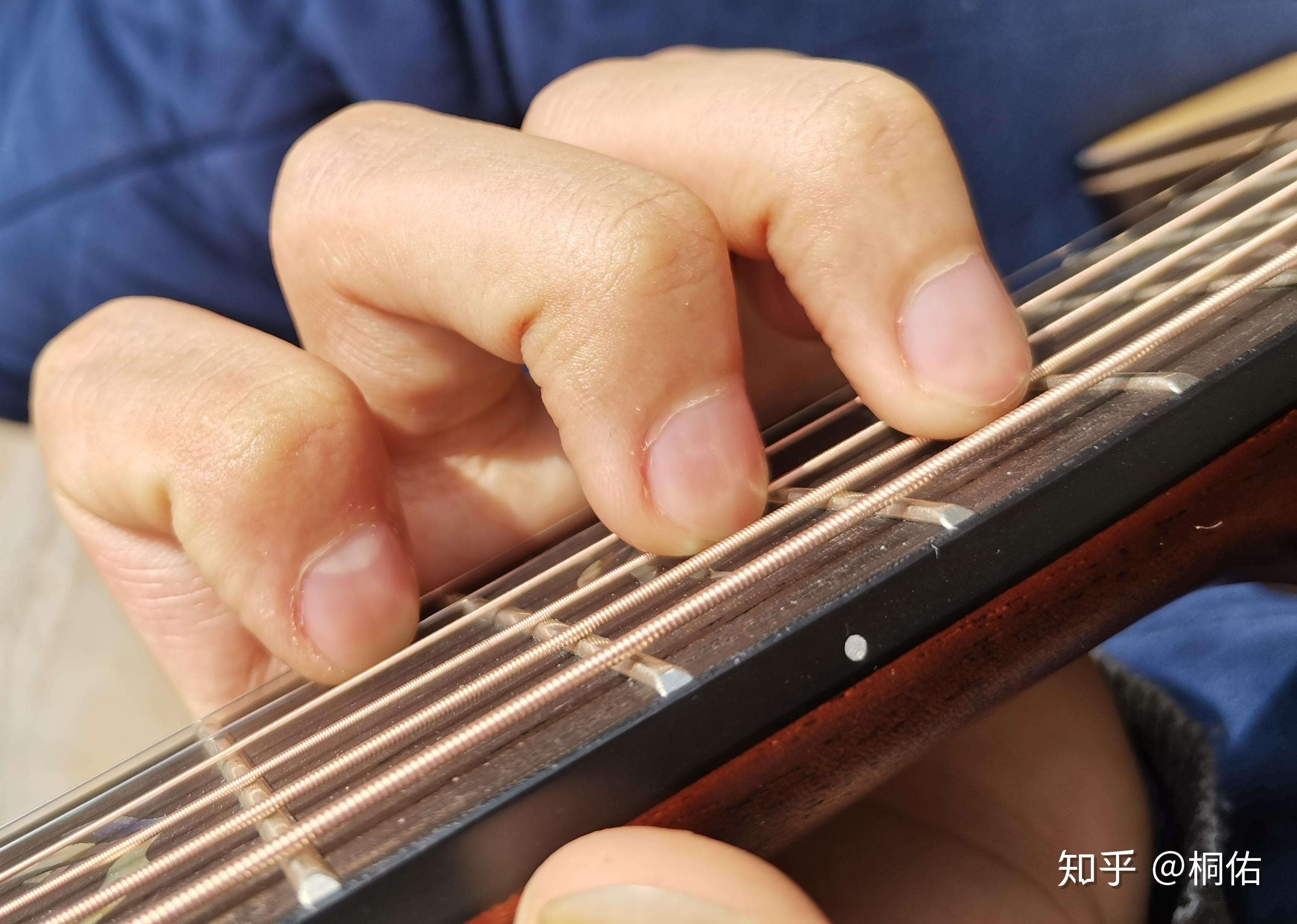 吉他按弦手指第二关节伸直是否会对手指造成伤害如腱鞘炎