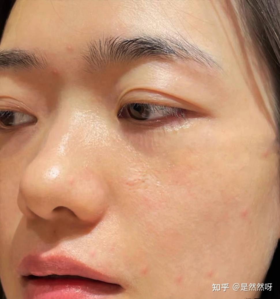 如果你用过很多抗初老产品后还是暗黄脸垮长细纹可以看看我的经历干货