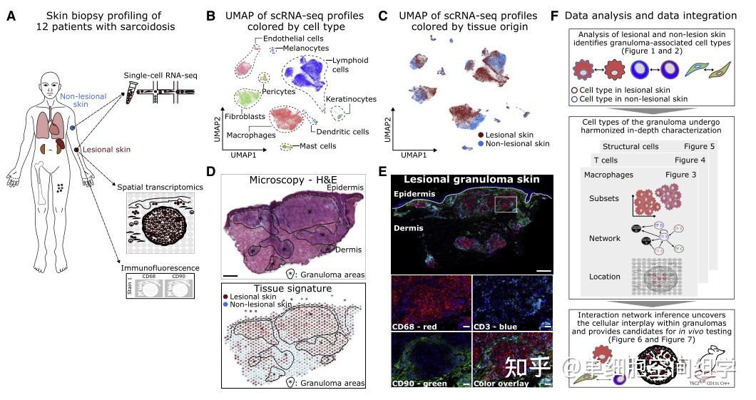 Immunity Tissue Cytometry原位单细胞精准定量技术结合空间转录组揭示肉芽肿和tls的形成可能具有相同的生物学过程 知乎