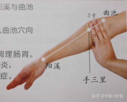 头痛或者偏头痛的快速缓解办法:,揉按手三里。 - 知乎