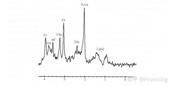 学习笔记280—磁共振波谱成像技术 - 何弈 - 博客园
