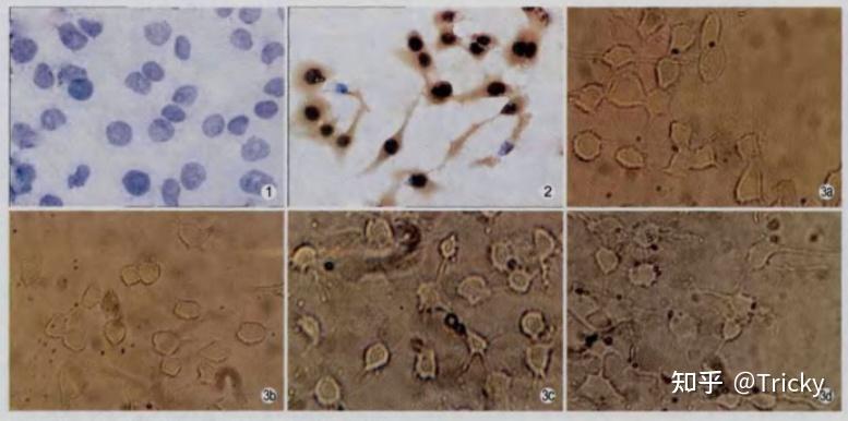 抗DNA IgM-SPDP/SPDP-C PC/SPDP-IL-8单克隆抗体/SPDP-EGFR mab-RTA - 知乎