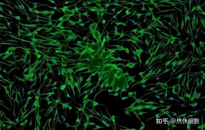 dc细胞肿瘤疫苗攻克癌症的新希望