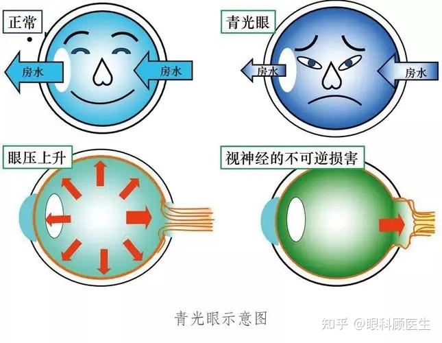 眼压24图片