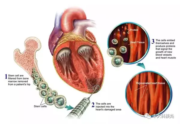 他們說,心肌幹細胞確實存在,甚至存在於成年的心肌細胞中,只要體外