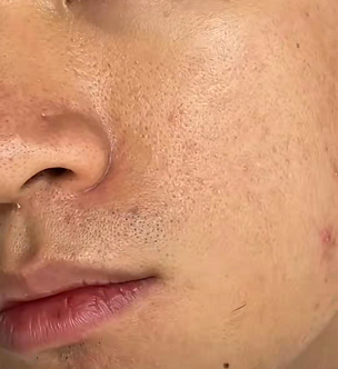 男生脸部皮肤又黑又糙,看起来没精神,要用什么护肤品?