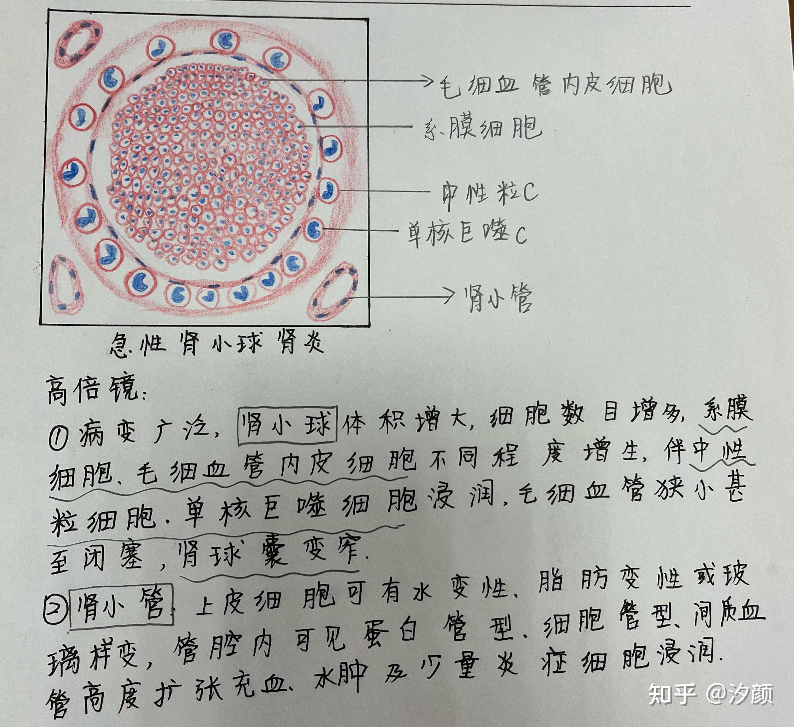 多核巨细胞红蓝铅笔图片