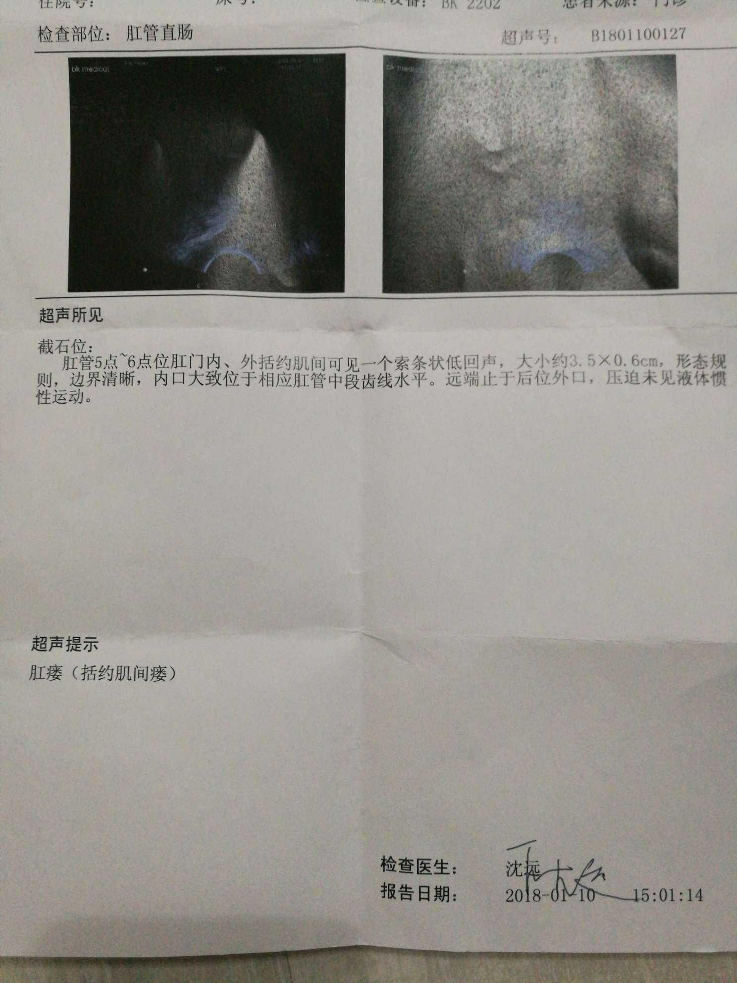 【经典回放】肛瘘MRI诊断_肛管
