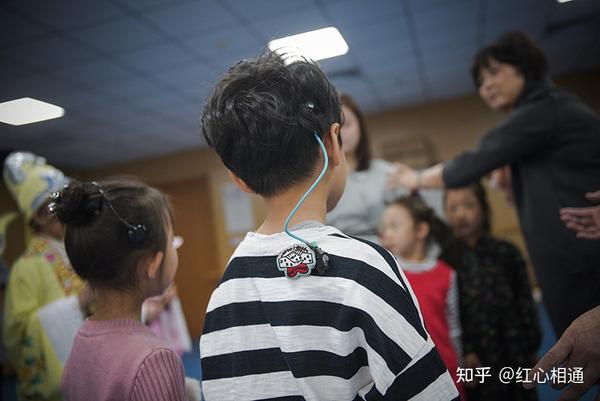 也许,2700万听障患者都可以重获新声 - 知乎
