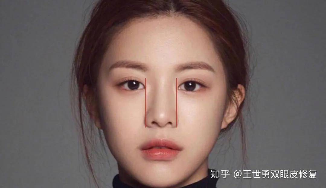 眼角最内侧不可超过眉头以及鼻翼的垂直线,其实这也是自测自己需不