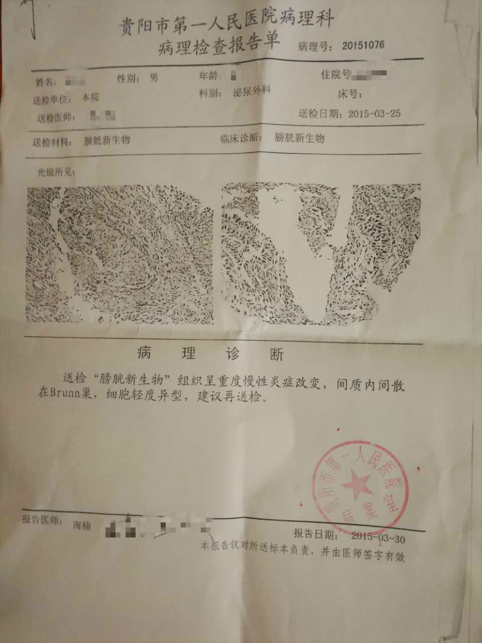 父亲于2017年5月15日检查出膀胱癌,在找平安保险理赔的时候,平安保险