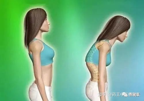 骨盆前倾还是后倾搞不清麻烦就大了