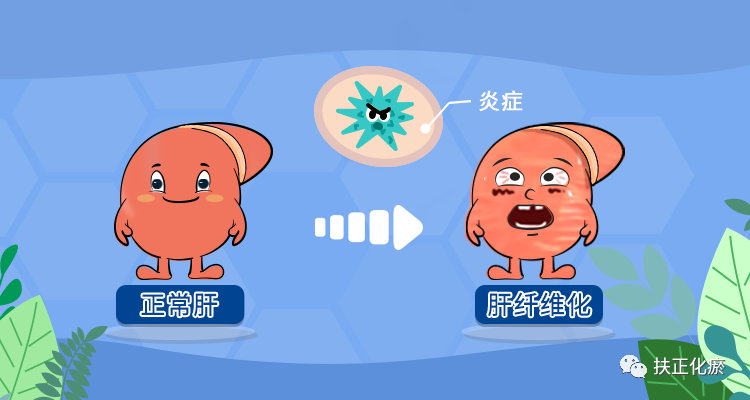 肝纖維化是存在於大多數慢性肝臟疾病過程中的必經病理過程,其本質是