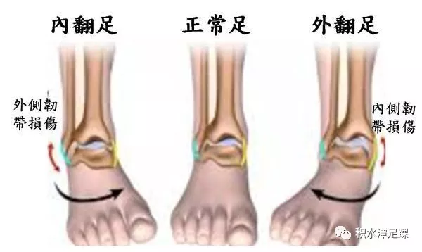 足踝生物力学6s中心图片