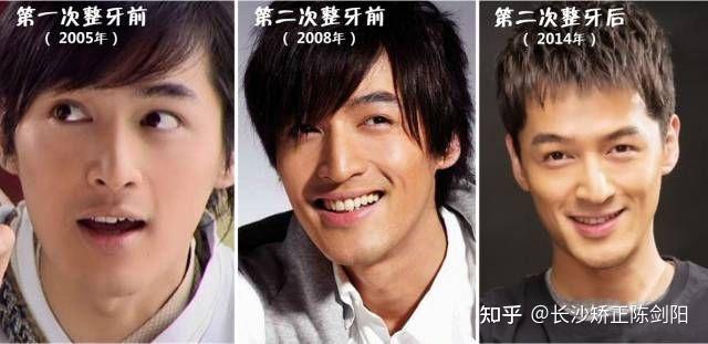 高中时期的胡歌模样已经定型,牙齿的矫正也很成功,脸型变化也很大