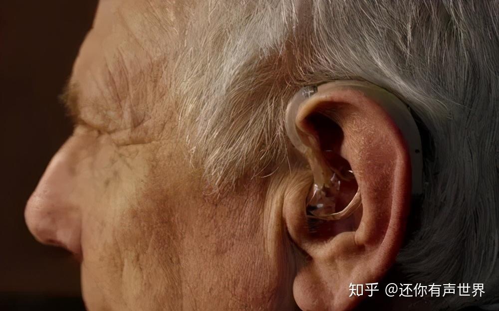 老年性聋的病因中年龄性老化并不是主要原因