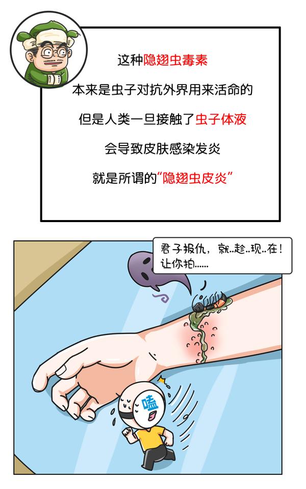 在中國的毒隱翅蟲僅有3種:黃足毒隱翅蟲(又叫梭毒隱翅蟲),黑足毒