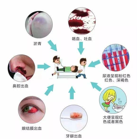 华法林出血症状图片图片