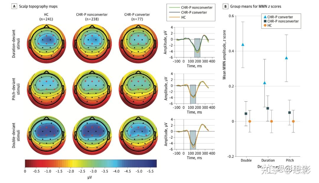 JAMA Psychiatry：临床精神疾病高危青少年对听觉异常反应的MMN与未来精神疾病的风险 - 知乎