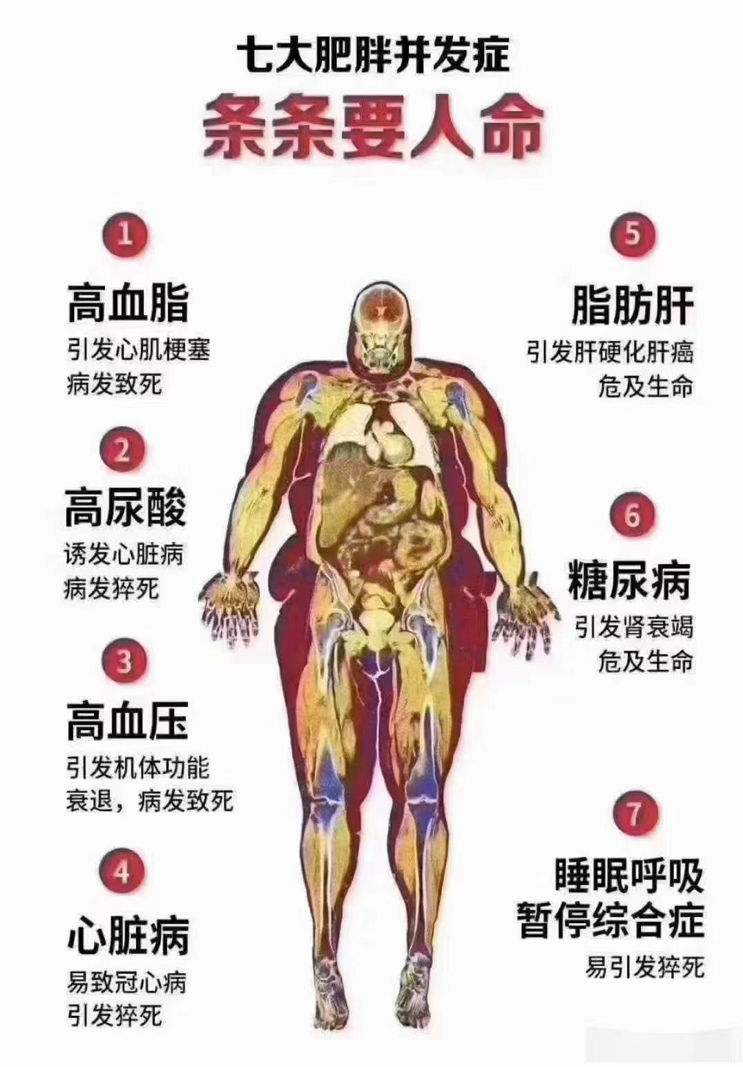 肥胖给我们带来的危害！ 知乎