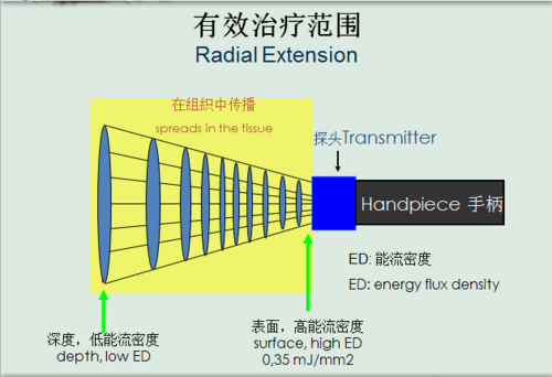 点阵体外冲击波治疗仪的原理和方法