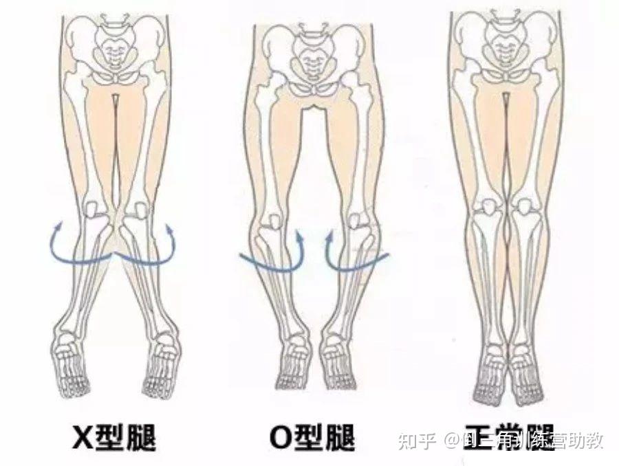 胫骨后倾角图片