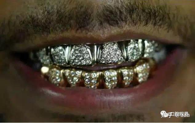 "铁齿铜牙"vs"唇红齿白",如何选择牙齿修复材料?