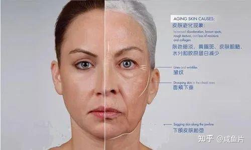 皮肤衰老主要有四大体现:干燥,暗沉,皱纹和松弛.