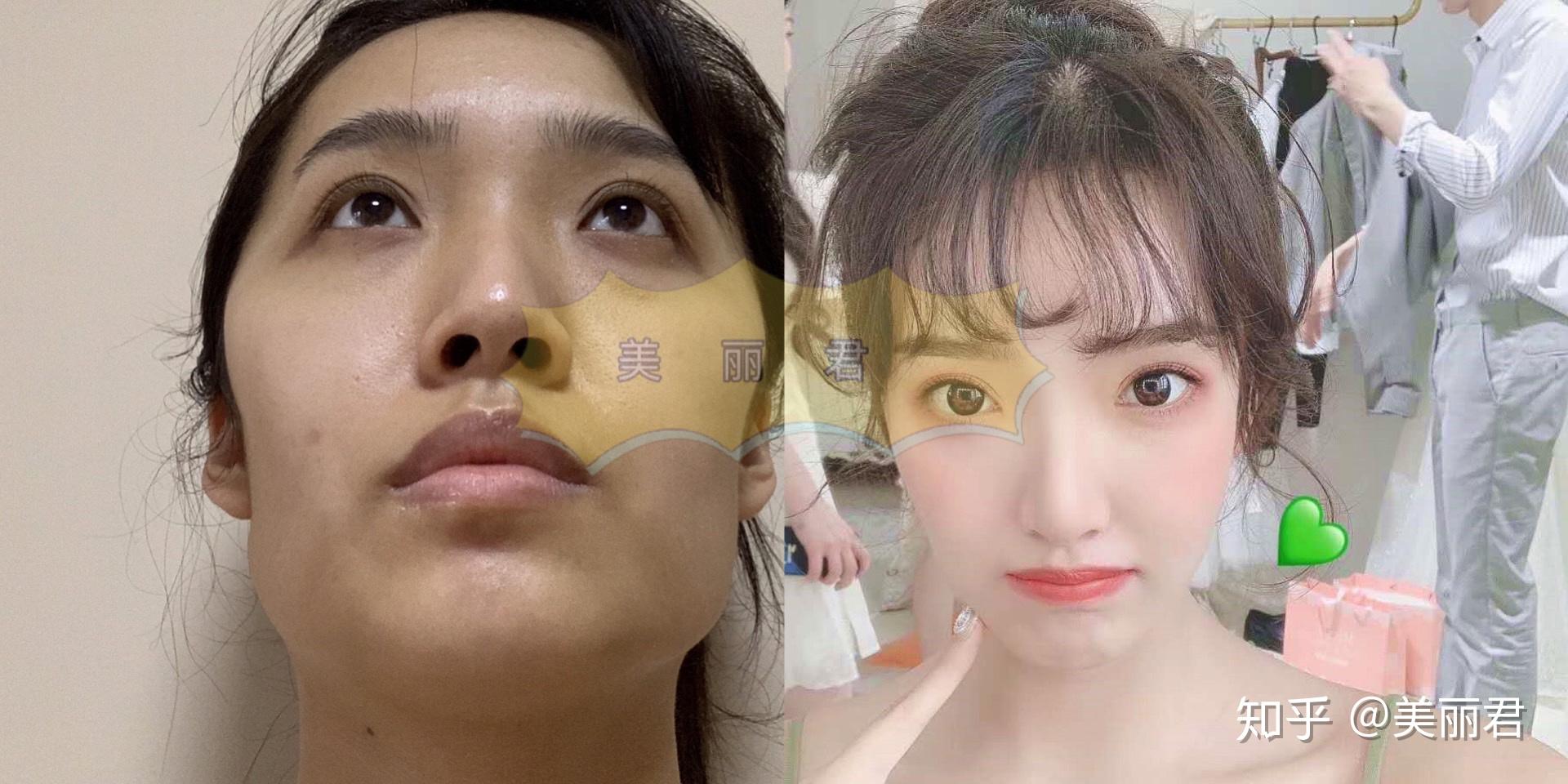 全花整容上了,到头来就得到一个整容脸的称号 - 知乎