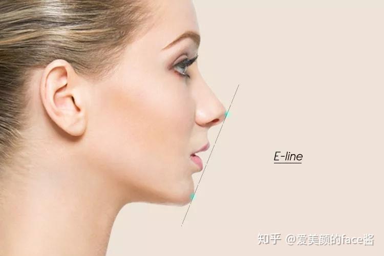 二次正畸能改善下巴后缩吗?