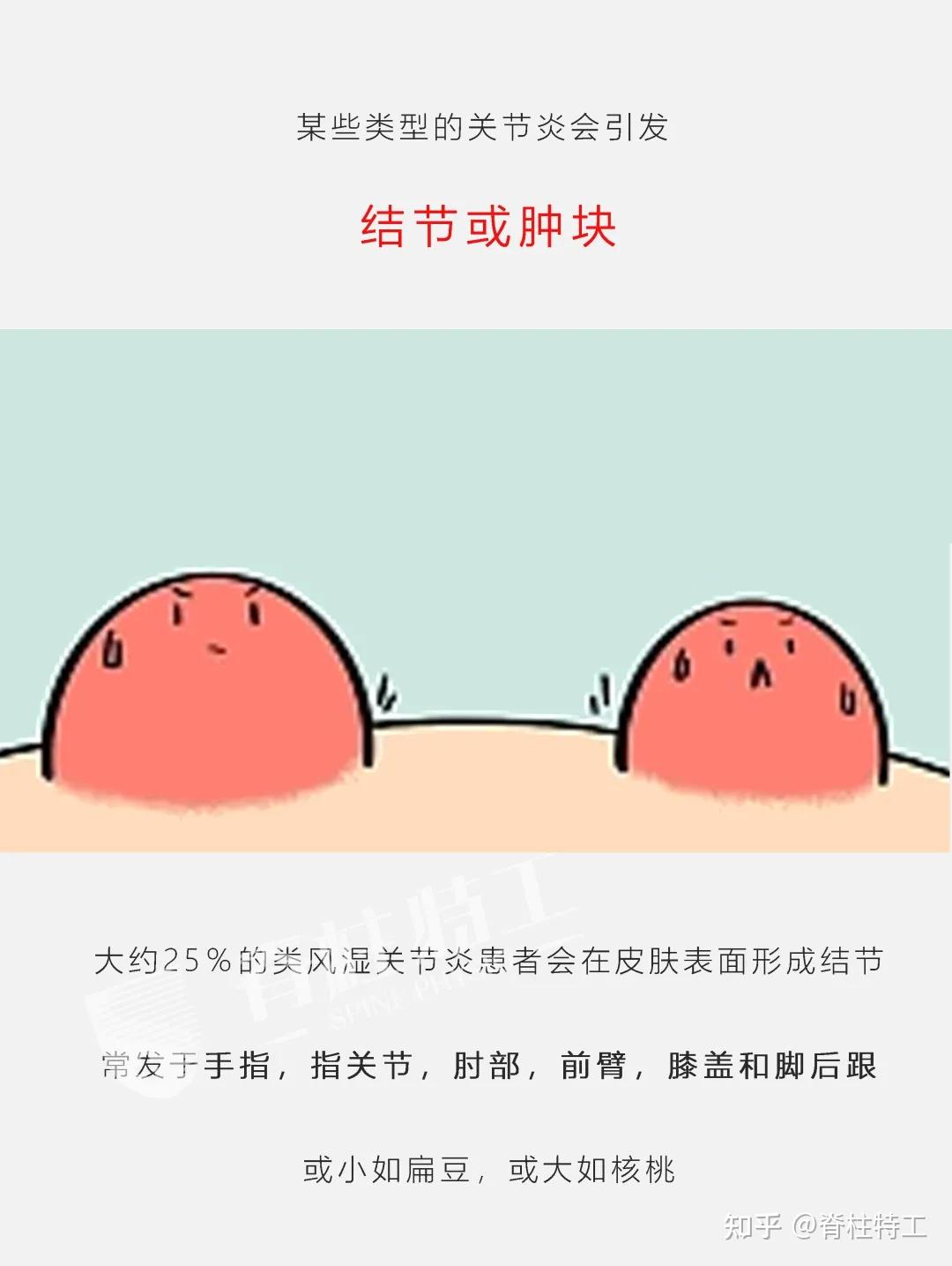 8,是否有皮肤结节