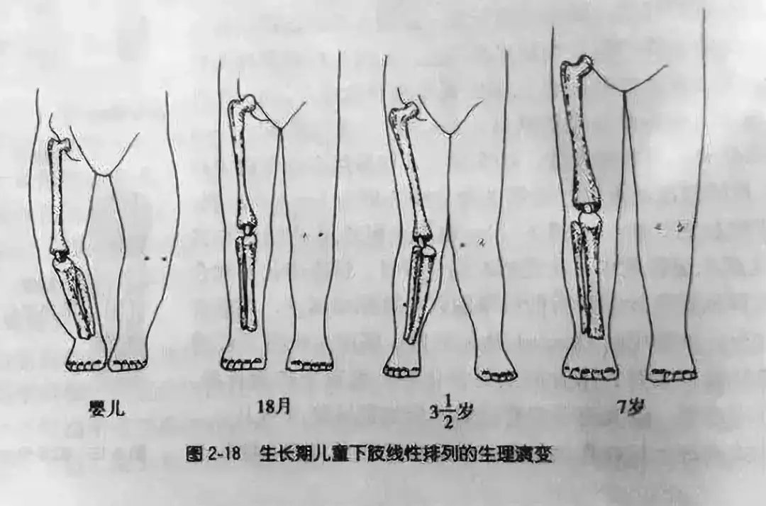 為什麼嬰兒腿會彎曲