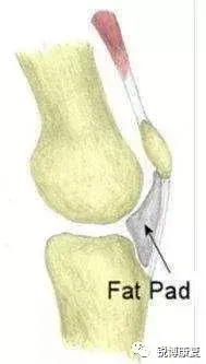 大家膝盖髌下脂肪垫炎都是如何痊愈的 髌下脂肪垫炎吃什么药好 双偶网