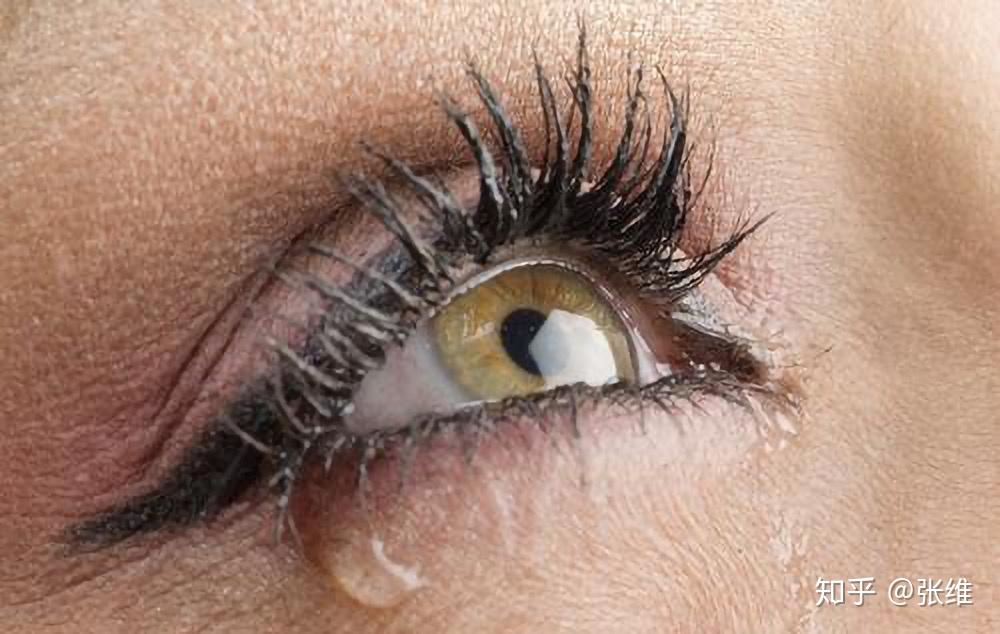 双眼皮儿你掉过的那些坑之五trap5流泪和溢泪