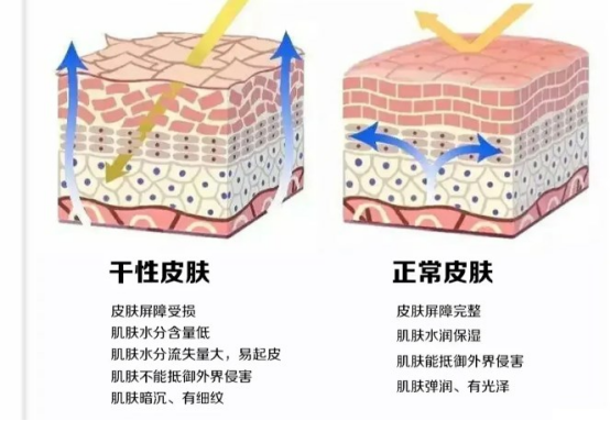 干皮女生该如何护肤？ - 知乎