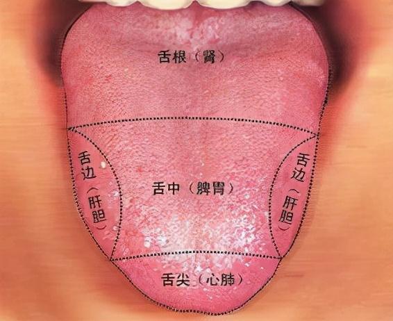 舌尖紅心火旺舌邊紅肝火旺舌全紅胃火旺送你簡單應對方法