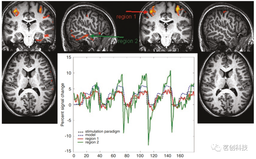 BOLD fMRI和DTI：伪影、技巧和诀窍 - 知乎