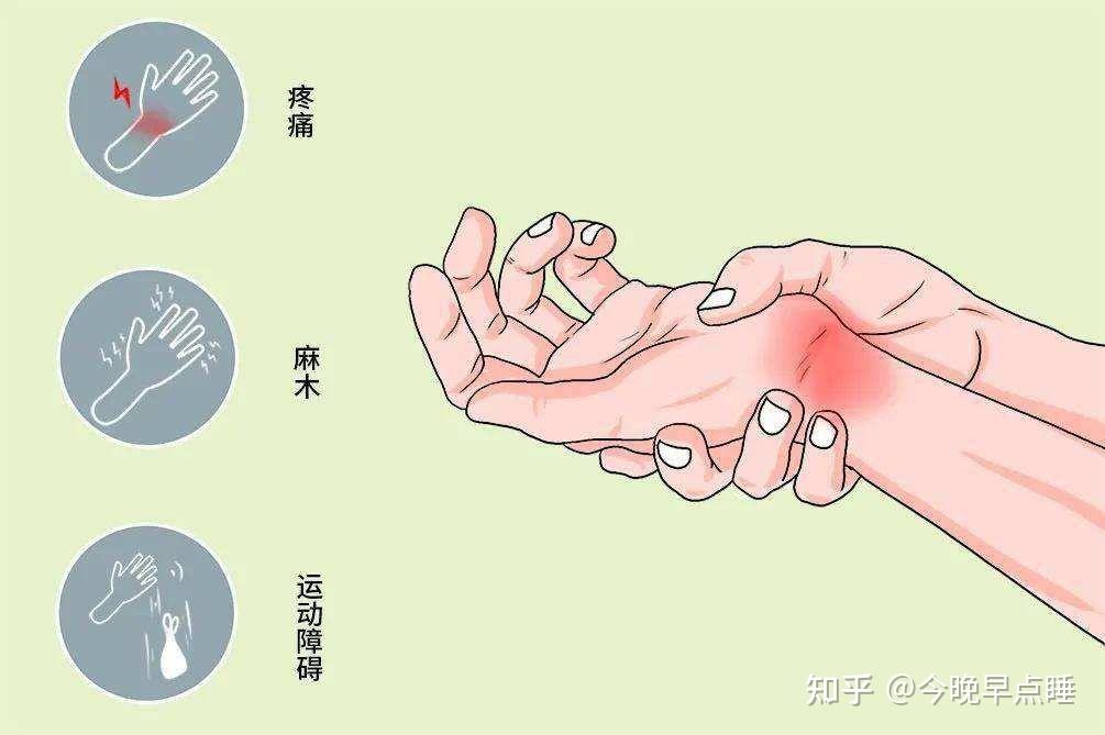 手腕鼓包怎麼回事十有八九是腱鞘炎寶媽們注意了