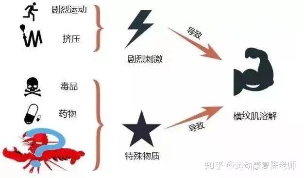 小心横纹肌溶解综合征!