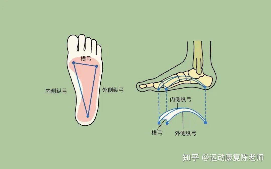 【锐博康复科普】没足弓,踝外翻,孩子扁平足该怎么办?