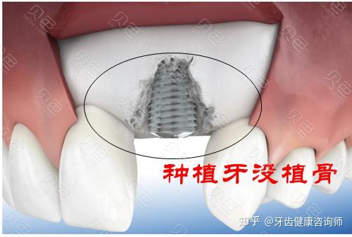 骨粉对植物的作用 哪些植物可以用骨粉 骨粉的危害及骨粉图片