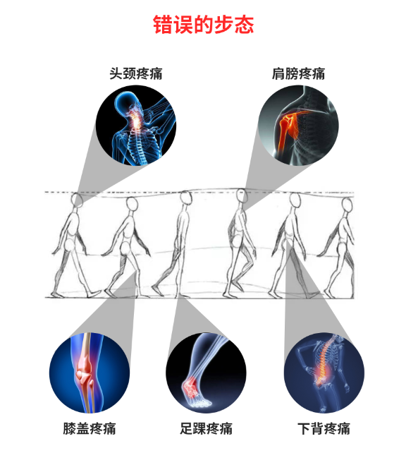为疾病埋下隐患进而导致异常步态往往伴随着长期无法解决的慢性疼痛