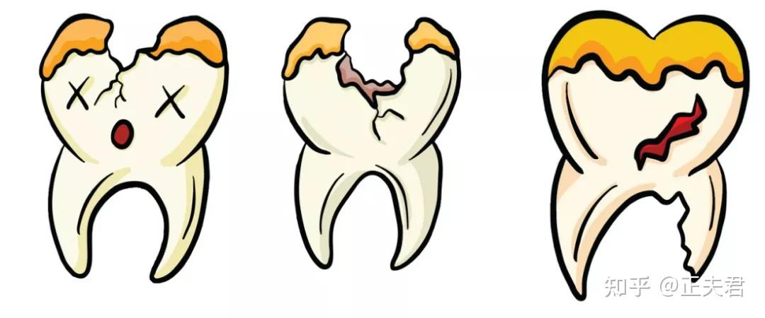 牙齿坏掉的图片卡通图片