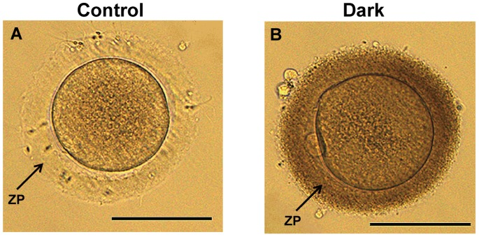 具有深色透明带的卵母细胞在 ivf/icsi 周期中表现出较低的受精率