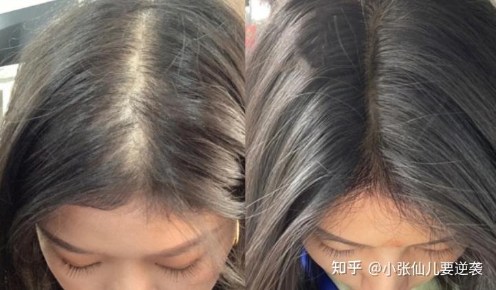 靠中科院博士推荐的育发液增加发量,为什么3个月发量猛增?宽发缝秃鬓角,脱发问题都改善了? - 知乎