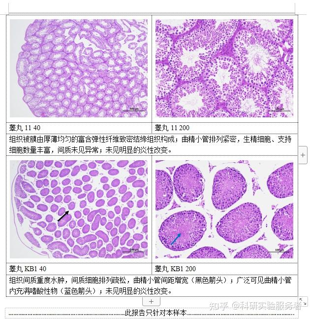 石蠟切片he染色實驗結果病理分析檢查報告上海鄭核